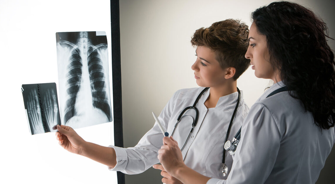 Two female doctors in white coats examining an X-ray of a human chest on a light board.