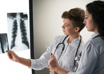 Two female doctors in white coats examining an X-ray of a human chest on a light board.