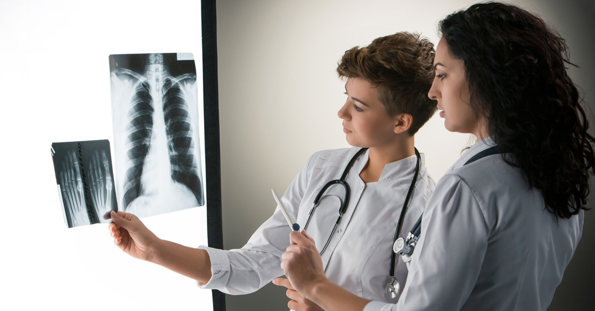Two female doctors in white coats examining an X-ray of a human chest on a light board.